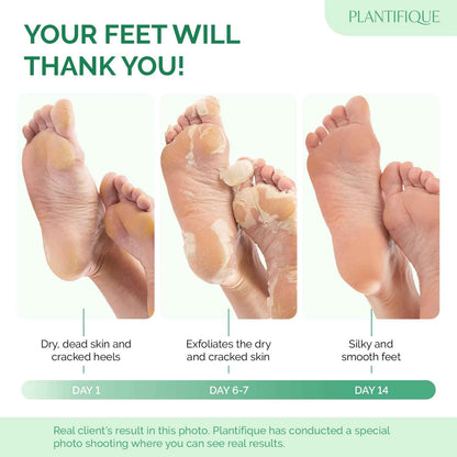 PLANTIFIQUE Foot Peel Mask Dermatologically Tested - 2 Pairs Peach Exfoliating Mask for Dry Cracked Feet - Masque Pied Peeling - Foot Care for Soft Baby Feet 🍁 All In One Marketplace Canada