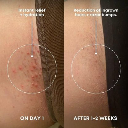 Bushbalm Ingrown Hair Exfoliating Scrub - Reduces Appearance of Ingrown Hairs and Razor Bumps, Soothes Skin and Post-Shave Redness - Nude, 236 ml 🍁 All In One Marketplace Canada