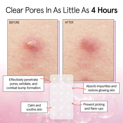 grace & stella Award Winning Invisible Spot Covers with Hydrocolloid (Round, 72 Count) - Spot Covers with Salicylic Acid and Tea Tree for Absorbing Impurities - Dermatologist Tested Skin Care, Cruelty Free, Vegan 🍁 All In One Marketplace Canada