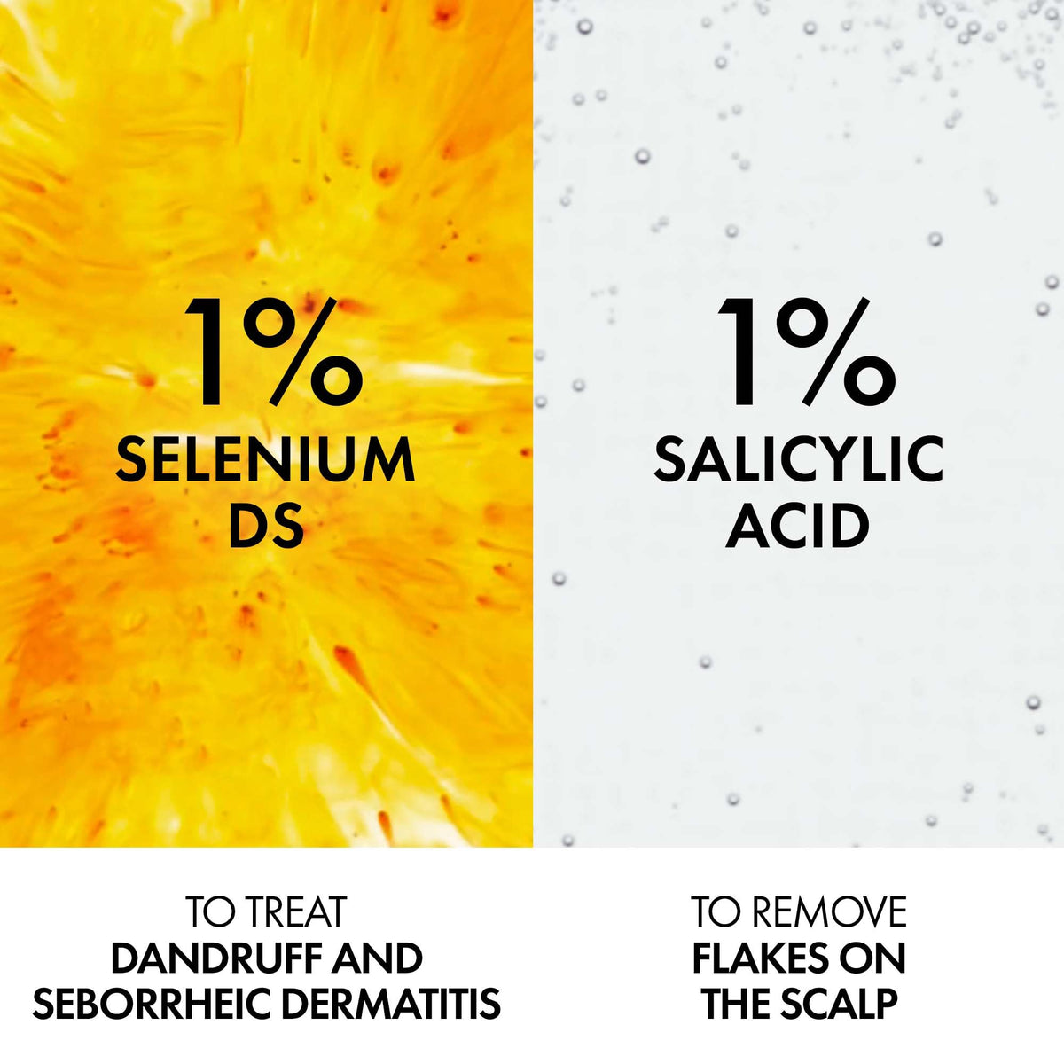 Vichy Dercos Dandruff Shampoo for Dry-Normal Hair, Anti Dandruff Soothing Scalp Care with Selenium DS & Salicylic Acid, Reduces Visible Dandruff Flakes & Improves Scalp Health, 200mL 🍁 All In One Marketplace Canada