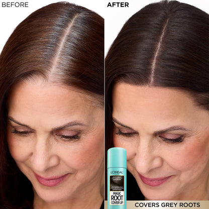 L'Oréal Paris Magic Root Cover Up Root Touch Up, Medium Brown Blonde Hair Dye, Root Touch Up Spray for Thinning Hair, Temporary Hair Dye, Grey Coverage, Pack of 2 🍁 All In One Marketplace Canada
