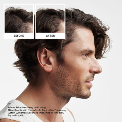 Nioxin Scalp + Hair Thickening System 2 Conditioner, For Natural Hair with Progressed Thinning, 16.9 fl oz (Packaging May Vary) 🍁 All In One Marketplace Canada
